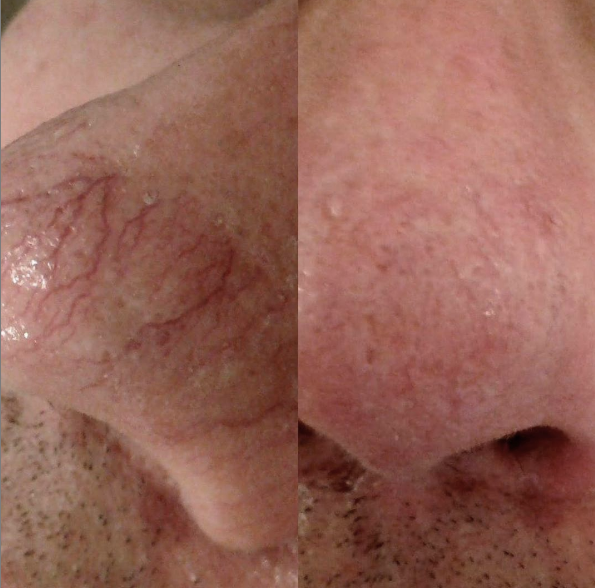 Veins